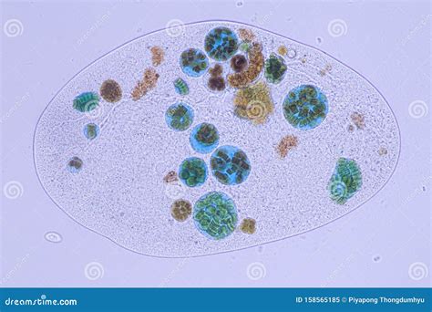  Keratella! Un Piccolo Protista che Vive Tra i Granelli di Sabbia e le Foglie in Decomposizione