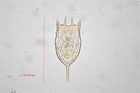  Keratella: Scopri la danza microscopica di questa creatura filtrante che si nutre di batteri e alghe!