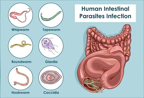 Nicolla: Un Parassita Intestinale con un Viaggio Vita Inaspettato!