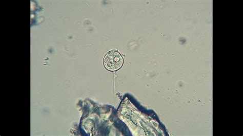  Vorticella! Un affascinante vortice di vita microscopica che pulsa nel mondo acquatico